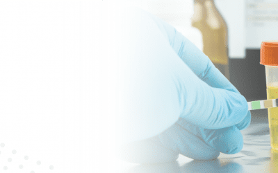 Abstinenznachweis für die MPU: Haaranalyse oder Urinscreening?